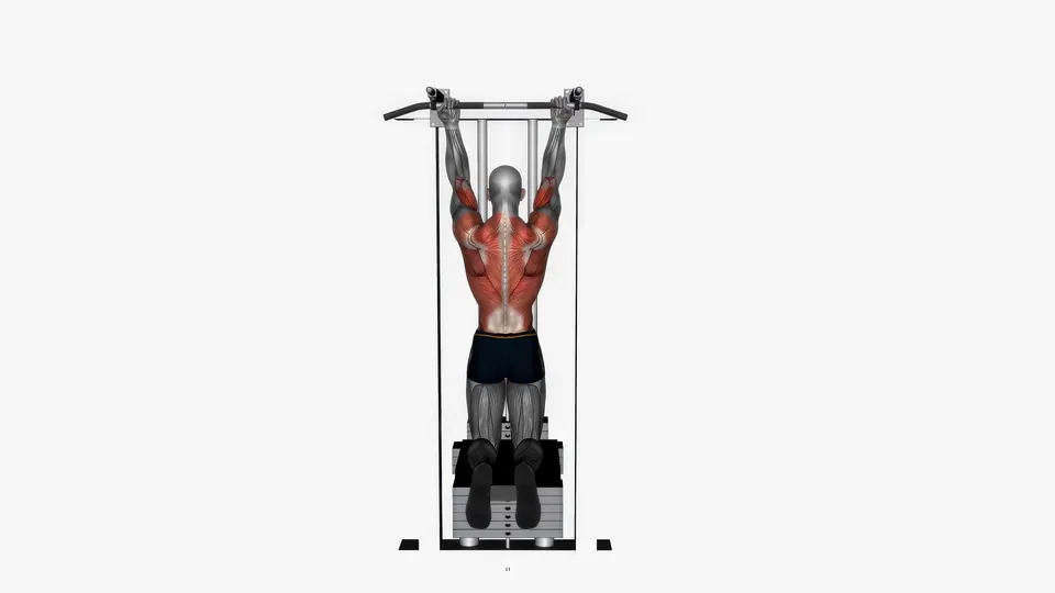 Assisted Chin-Up